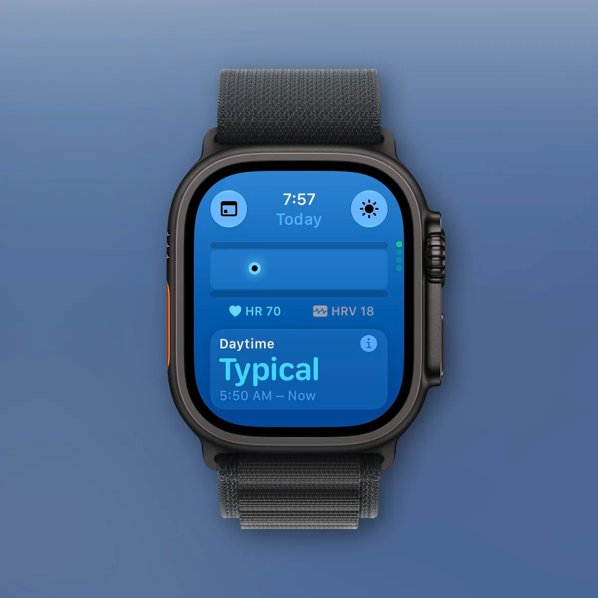Apple Watch Series 12 and Ultra 4 not only know more about you now than: What it means for fans